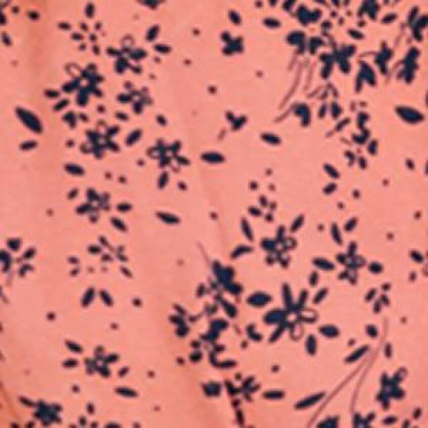 Multi